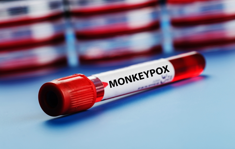 Monkeypox
