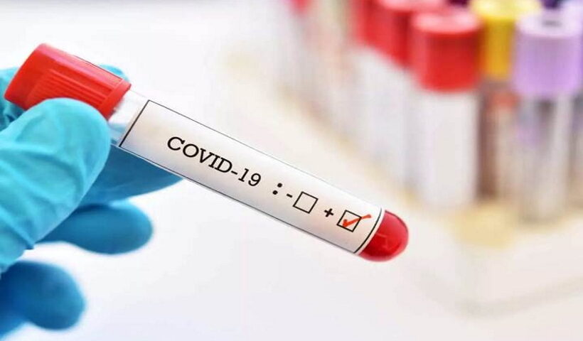 coronavirus.