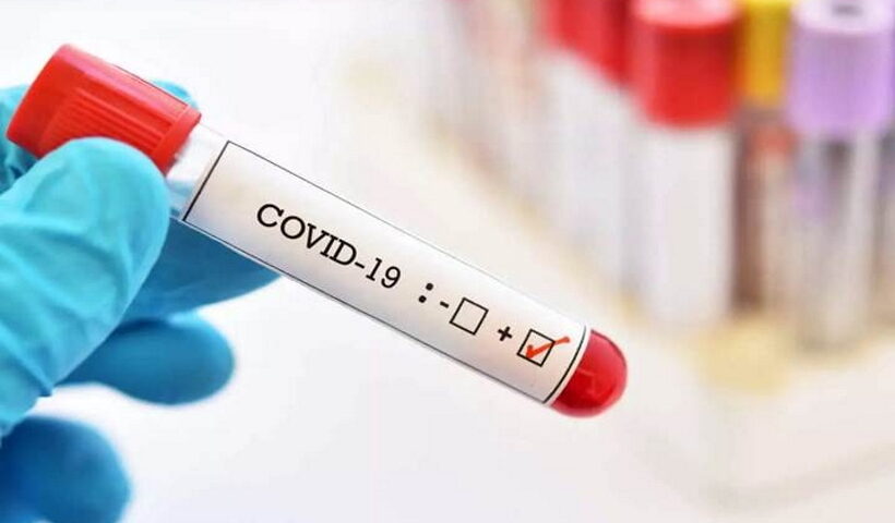 coronavirus.