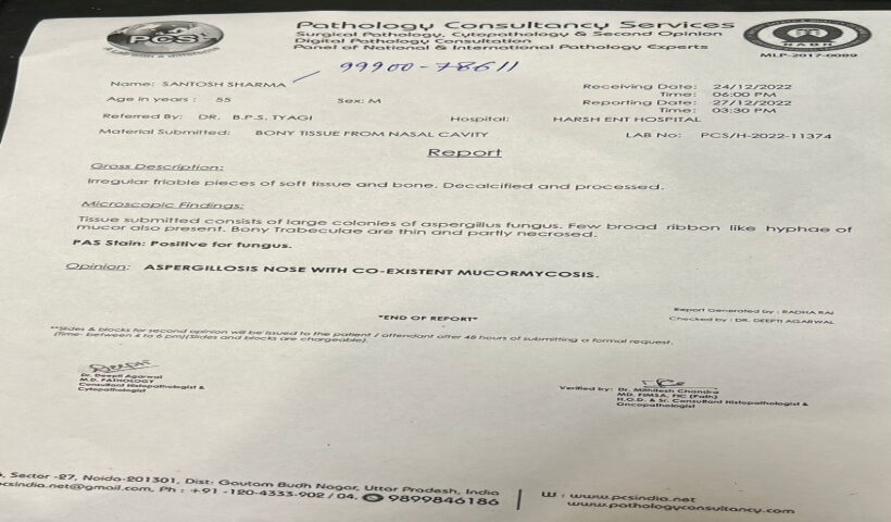 First patient of both black and white fungus found in Ghaziabad.