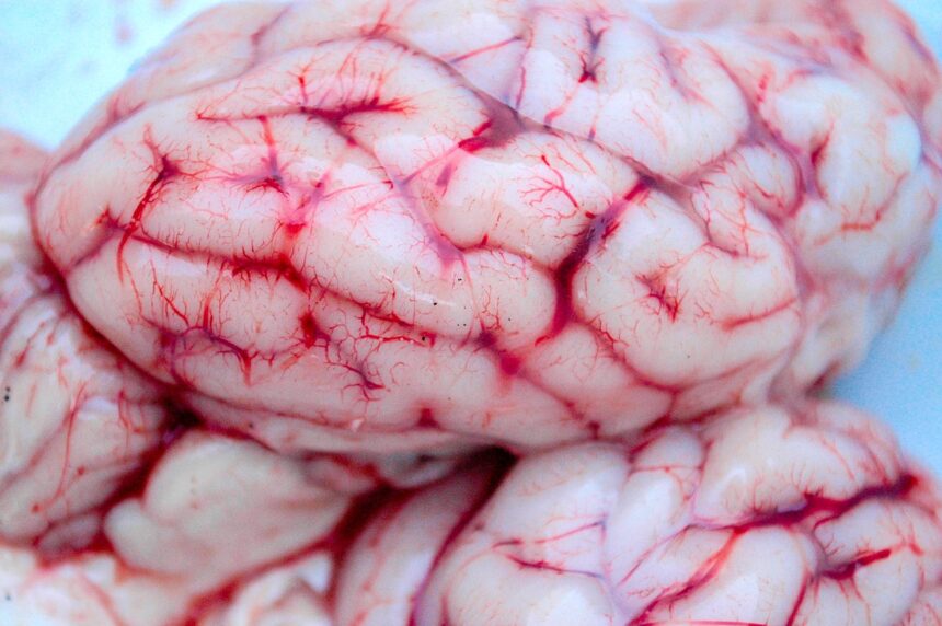 Brain
