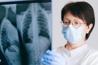 Lungs X-ray scan