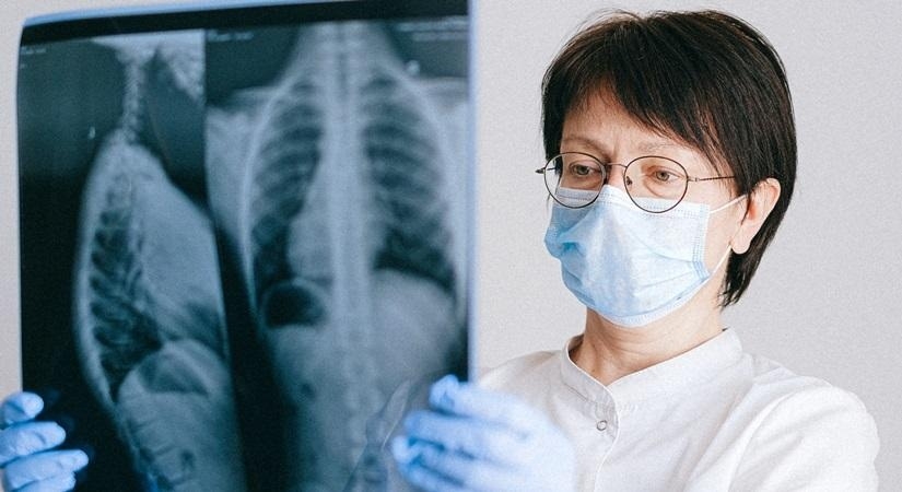 Lungs X-ray scan