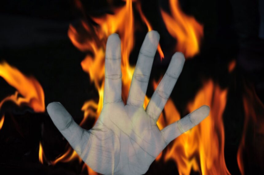 Burning