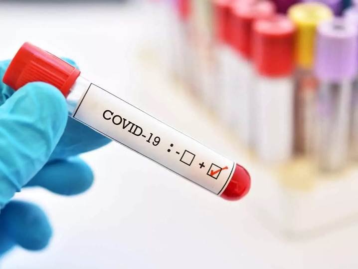 COVID-19 test sample