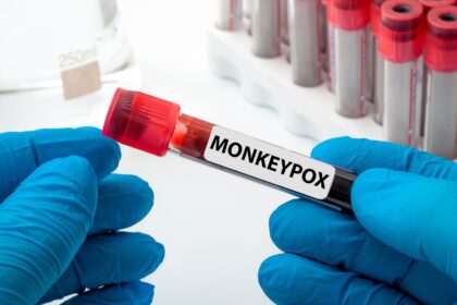 Monkeypox