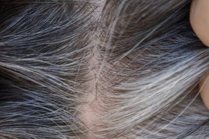 US scientists decode why our hairs turn grey