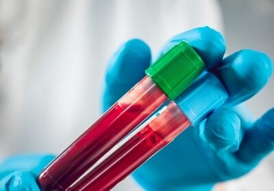 Blood sample