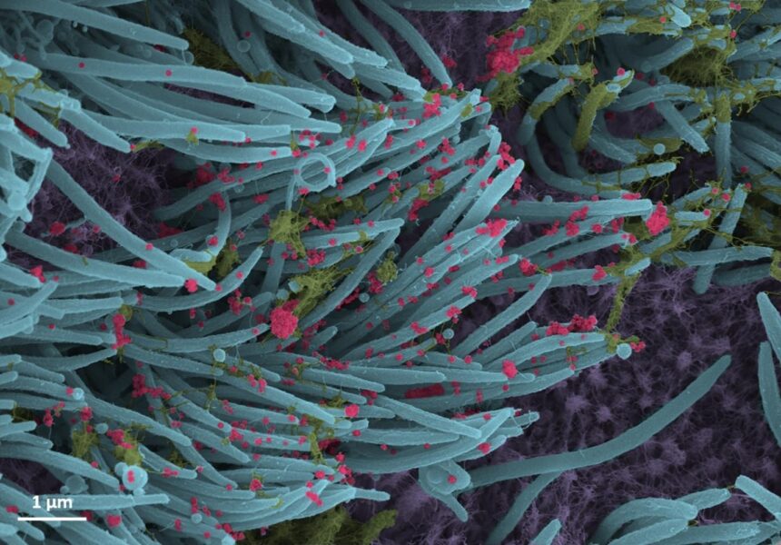 New coronavirus seen up close in graphic details inside lungs