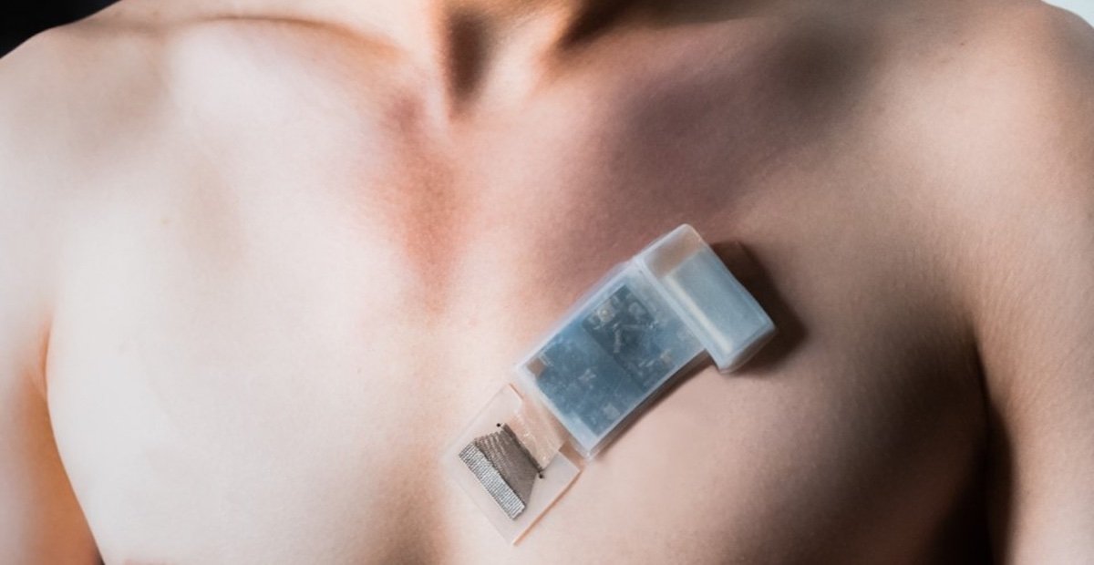 New wearable ultrasound system can monitor BP, heart function on the go
