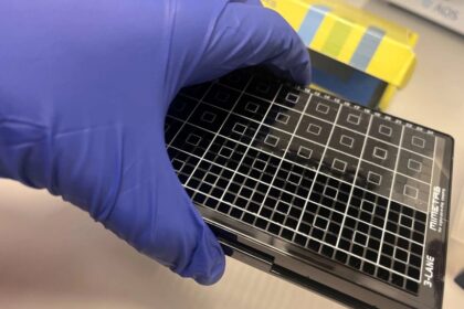 New Placenta On A Chip Model To Address Preeclampsia In Pregnancy